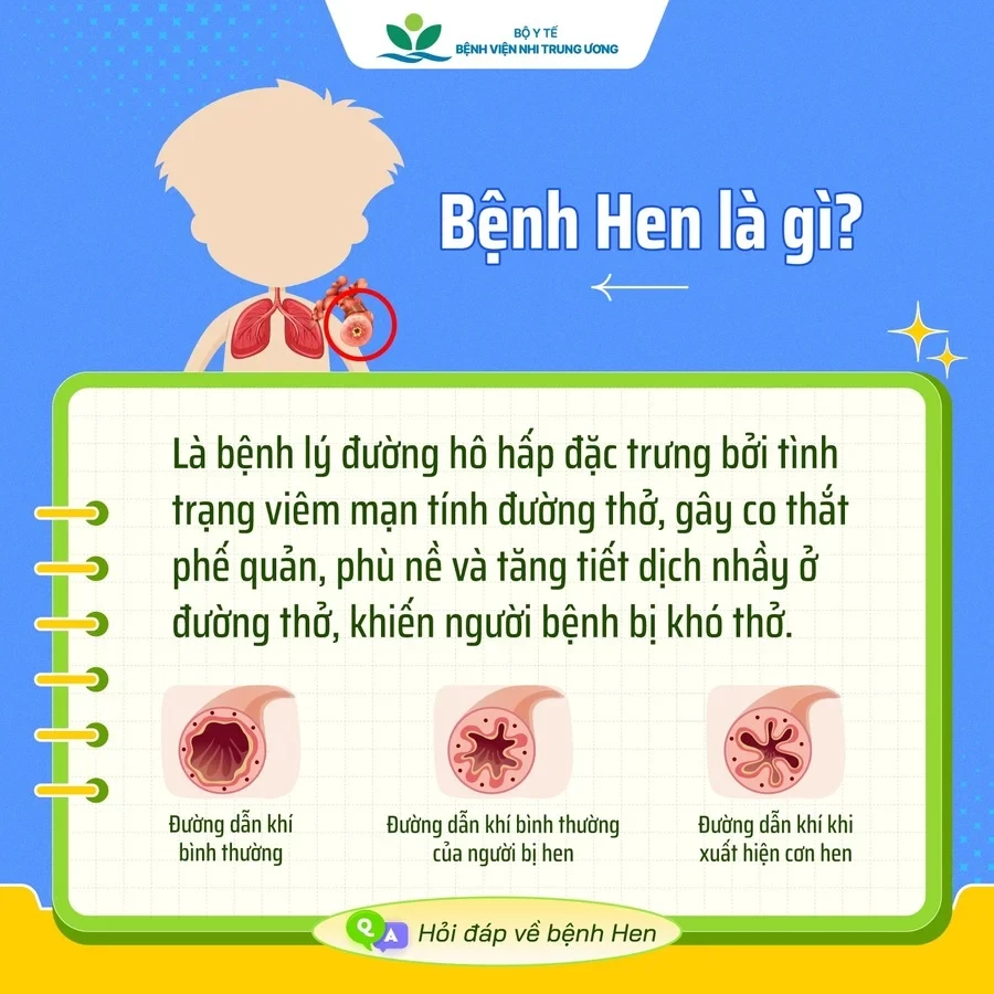 nang-cao-hieu-biet-ve-benh-hen-de-chu-dong-bao-ve-suc-khoe-cho-tre-2-1746580880.webp